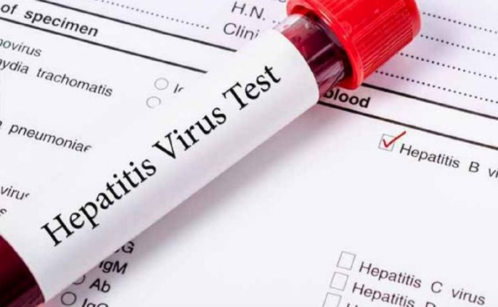 غربالگری هپاتیت در معتادان تحت درمان از اواخر شهریور؛ درمان رایگان هپاتیت در کشور