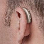 مبلغ پوشش بیمه ها برای خرید سمعک چقدر است؟